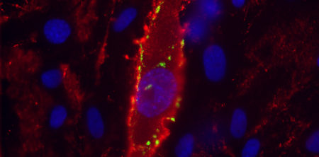 Reconstructed Cell Tray for Detection of Transplant Rejection