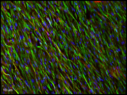 Novel Configuration of Tissue-Engineered Small Vascular Replacement